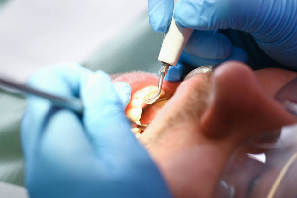 Best Cosmetic Emergency Dentistry in Rocky Mount, NC